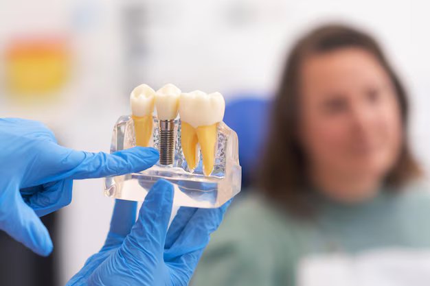Why Dental Implants overview