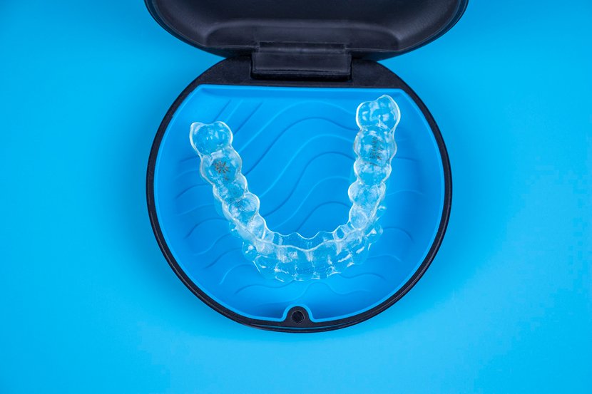 Why Invisalign overview