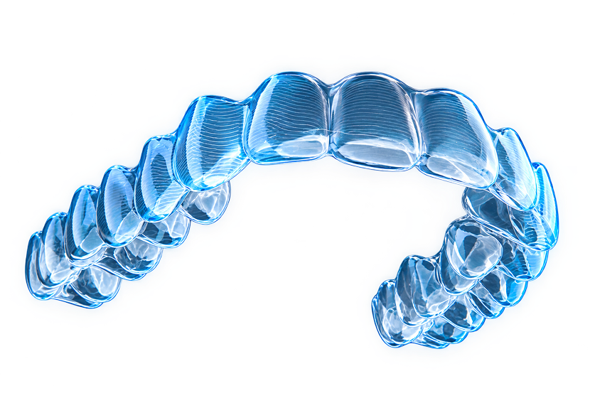 Invisalign for Children overview